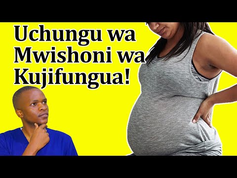 Video: Je, ni mpangilio gani sahihi wa hatua za mitosis?