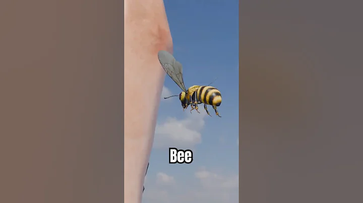 He got stung by a bee 😱