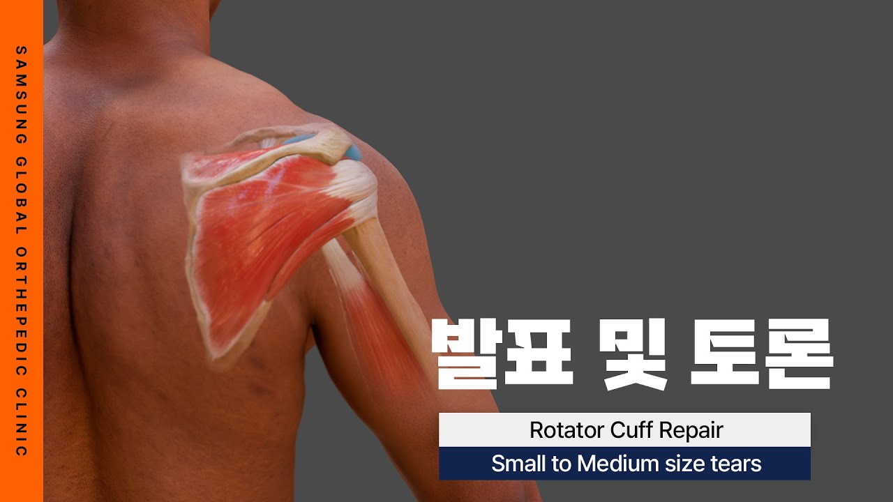[SGOC 아카데미] Rotator Cuff Repair : Small to Medium Size Tears #회전근개파열 ...