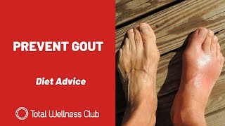 GOUT explained | Gout in the hand, foot or knee | Gouty Arthritis