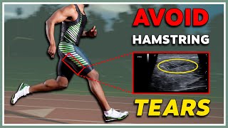 Hamstring tear ... again - How to avoid and heal them.