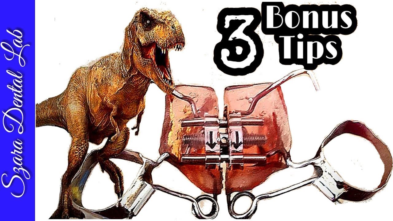 Distalizing Orthodontic Pendulum Appliance Lesson TREX YouTube