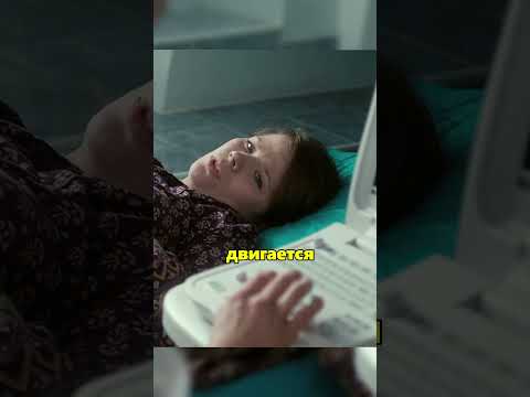 По шкале Апгар 2-3 бала Молчит😳 Маму пытаются спасти #тестнабеременность #сериал #фильмы