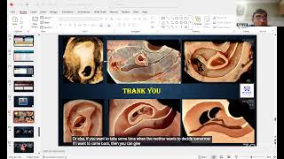 29.7.26 IMS webinar