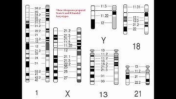 Cytogenetics II   Chromosome Analysis & Karyotypes