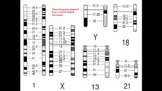 Cytogenetics II   Chromosome Analysis & Karyotypes