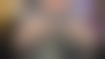 ASMR- Most Satisfying Dandruff Removal With Scalp Check Scratching- Massaging (no talking)✨💆🏻‍♀️