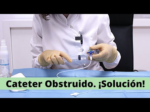 Vídeo: 3 maneres de desbloquejar un catèter