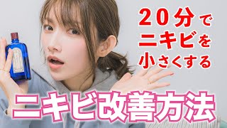 【肌荒れニキビケア】ニキビをたった20分で小さくする?!ゴマキの最強おすすめスキンケア【美肌】