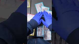 Tips On How To Assemble A Full Mouth Series Of X-Rays