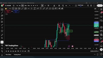 99% WIN RATE! LIVE AI TRADING GOLD  (XAU/USD) - Signals in Real-Time