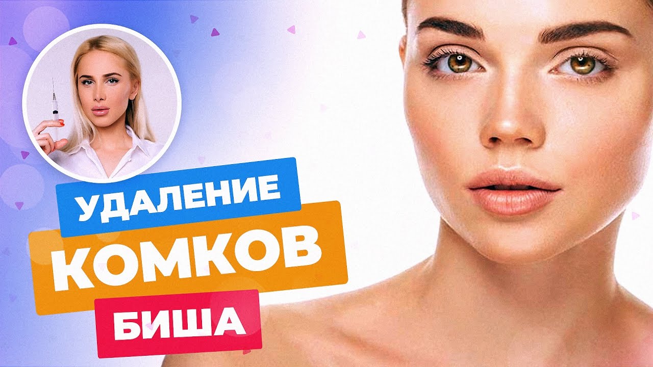 Что такое комки Биша и зачем их удаляют? Какие могут быть последствия? || Опыт ТАТЬЯНЫ КУШНИРЕНКО