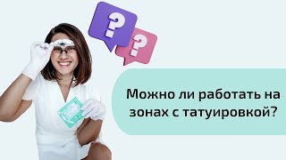 Можно ли делать электроэпиляцию на тату? Электроэпиляция в зонах татуировок мнение эксперта.