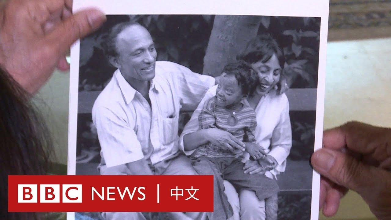 魚鱗癬女嬰遭遺棄遇上愛心夫婦翻轉人生 東森新聞 魚鱗癬女嬰遭遺棄遇上愛心夫婦翻轉人生 東森新聞