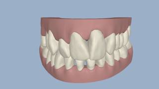 Invisible Orthodontics - Mondahl Patricia