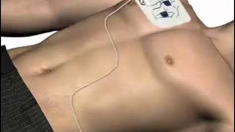 AED defibrillator Powerheart G3 Plus user demo Cardiac Science.wmv