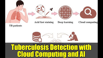 Tuberculosis Detection with Cloud Computing and AI