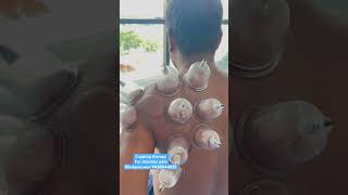 Cupping Therapy Bhubaneswar 9438044855 | Divine Physiotherapy | Dr Asimjit Swain