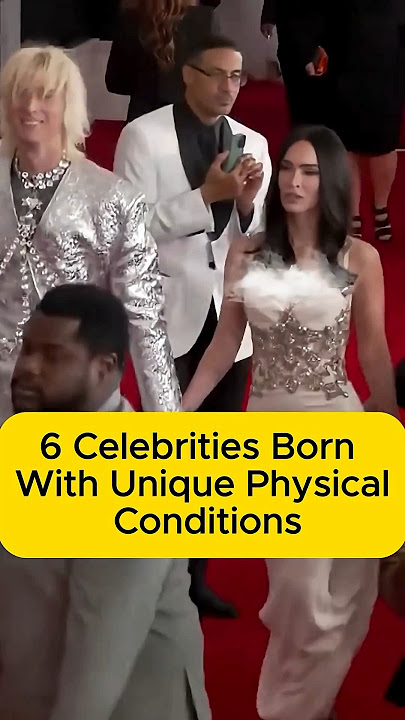 6 Celebrities Born With Rare Physical Conditions 😳 | You Won’t Believe #3! #shorts #hollywood