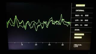 FPGA Signal Analyzer Demo