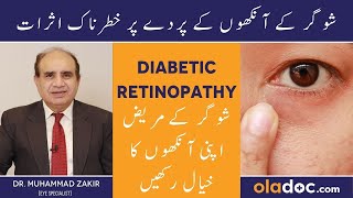 Eye Problems Due To Diabetes - Sugar Ka Ankhon Per Asar - Diabetic Retinopathy Treatment In Urdu