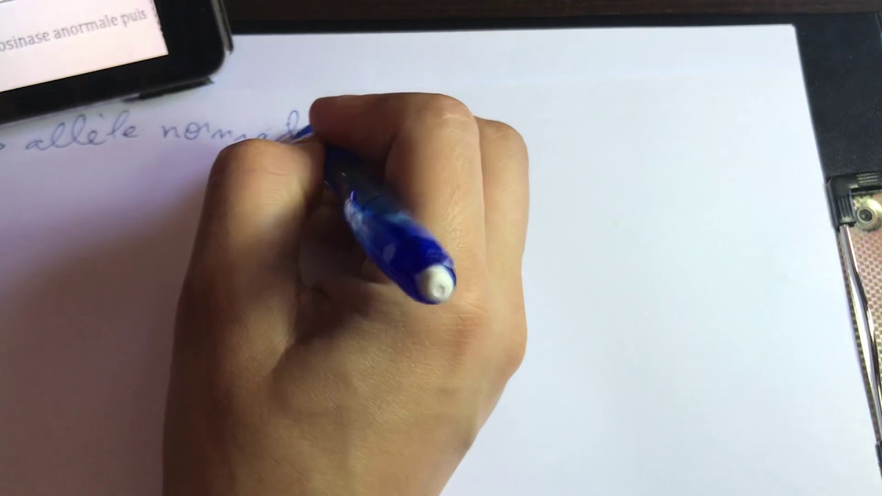 Exam:exercice génétique/adn-arn-acide aminé/réponse de la question:donner la relation gène-caractère