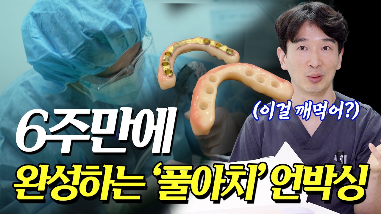 2026년 최신 기준! 6주만에 완성하는 전체임플란트 풀아치 언박싱! #치과 #풀아치 #노본아치