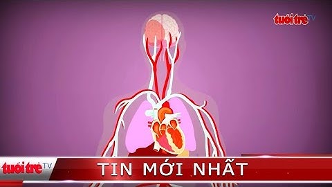 ⚡ Cẩn trọng | Có thể phòng chống đột quỵ bằng cách thay đổi lối sống