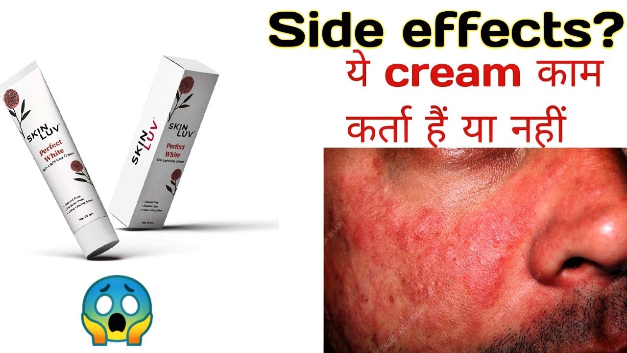 Skin Luv Cream Review  | skin luv perfect white skin lightning cream | skin luv cream side effects