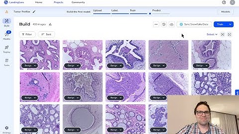 Snowflake and LandingAI Collaborate to Make Complex Diagnoses Easy