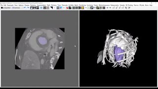 Cardiac Imaging Analysis - Imalytics Preclinical Application Demo