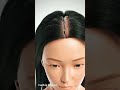 Baldness Explained Inside the Human Body #Baldness #HairLoss #ScalpHealth #MedicalCGI