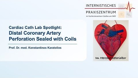 Coronary artery perforation sealed with coils