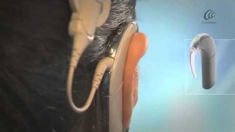 Nucleus® 5 - Using the telecoil Simple User Interface