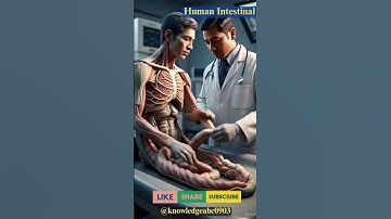 Intestinal Intussusception Explained in 3D – Must Watch!