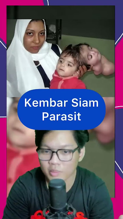 Kembar Siam ada yang BERBAGI SUAMI  #shorts #shortsindonesia #indonesia