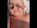 Adorable Baby With Blue Eyes The Babies World Shorts 
