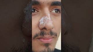 Remove White heads and black heads from nose using fevicol !! #shorts #short #beautytips #blackheads