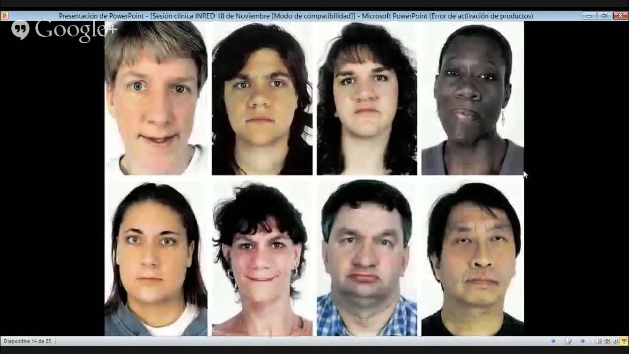 Гипер-ige синдром (синдром джоба). Синдром гипериммуноглобулинемии е. Гипер е. Гипер-ige синдром (синдром джоба). Гипер igm синдром иммунология.