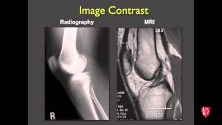 Medical Student Lecture: Introduction to Musculoskeletal Imaging screenshot 5