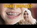 Fake Braces