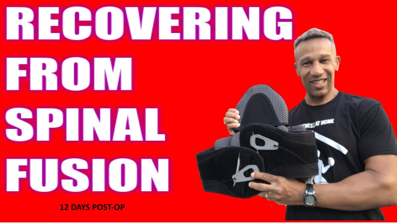 TLIF Fusion Surgery Recovery L4 L5 12 Days Post Op tlif-fusion-surgery-recovery-l4-l5-12-days-post-op