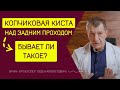 КОПЧИКОВАЯ КИСТА над задним проходом. Бывает ли такое?