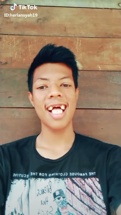 Video lucu gigi ompong