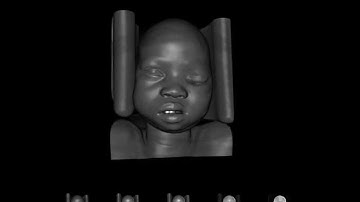 Instant Volume Visualization using Maximum Intensity Difference Accumulation (4)