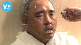 Qi - The Art Of Traditional Chinese Medicine Full Documentary