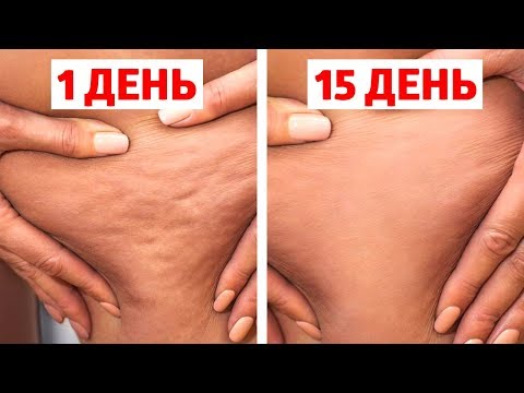 ЦЕЛЛЮЛИТ УЙДЕТ НАВСЕГДА, ЕСЛИ ДЕЛАТЬ ЭТО КАЖДЫЙ ДЕНЬ!