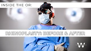 Rhinoplasty Surgery by Dr.Wise, Wise Center New Jersey - (973) 305-1400