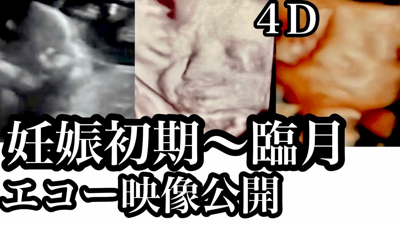 4dエコー公開 妊娠初期 臨月 赤ちゃんの成長記録 臨月妊婦 Youtube