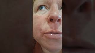 Общаемся О Планах Покупки Дребедени С Медсестрой